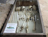 Seviac : site de la villa de Seviac à Montréal du Gers, squelettes de deux adolescents
